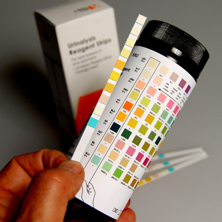 Urine Drug Test Kits | UK Drug Testing | Buy Online – UKDrugTesting